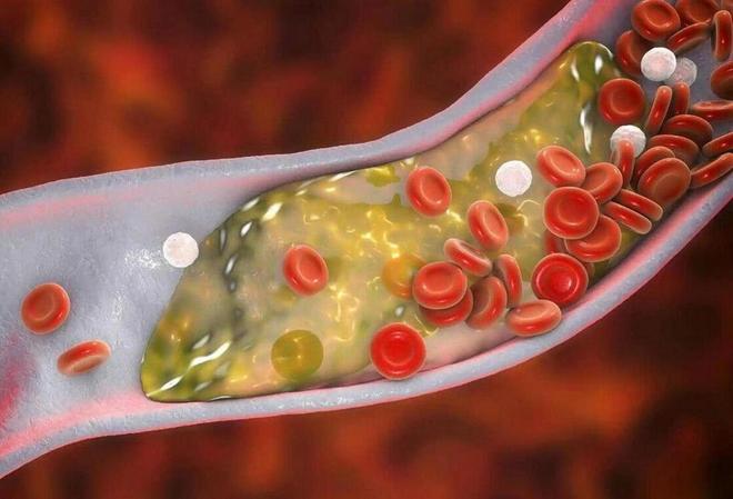 医生强调：早上经常吃鸡蛋的老人过不了多久身体或有4个改变(图3)